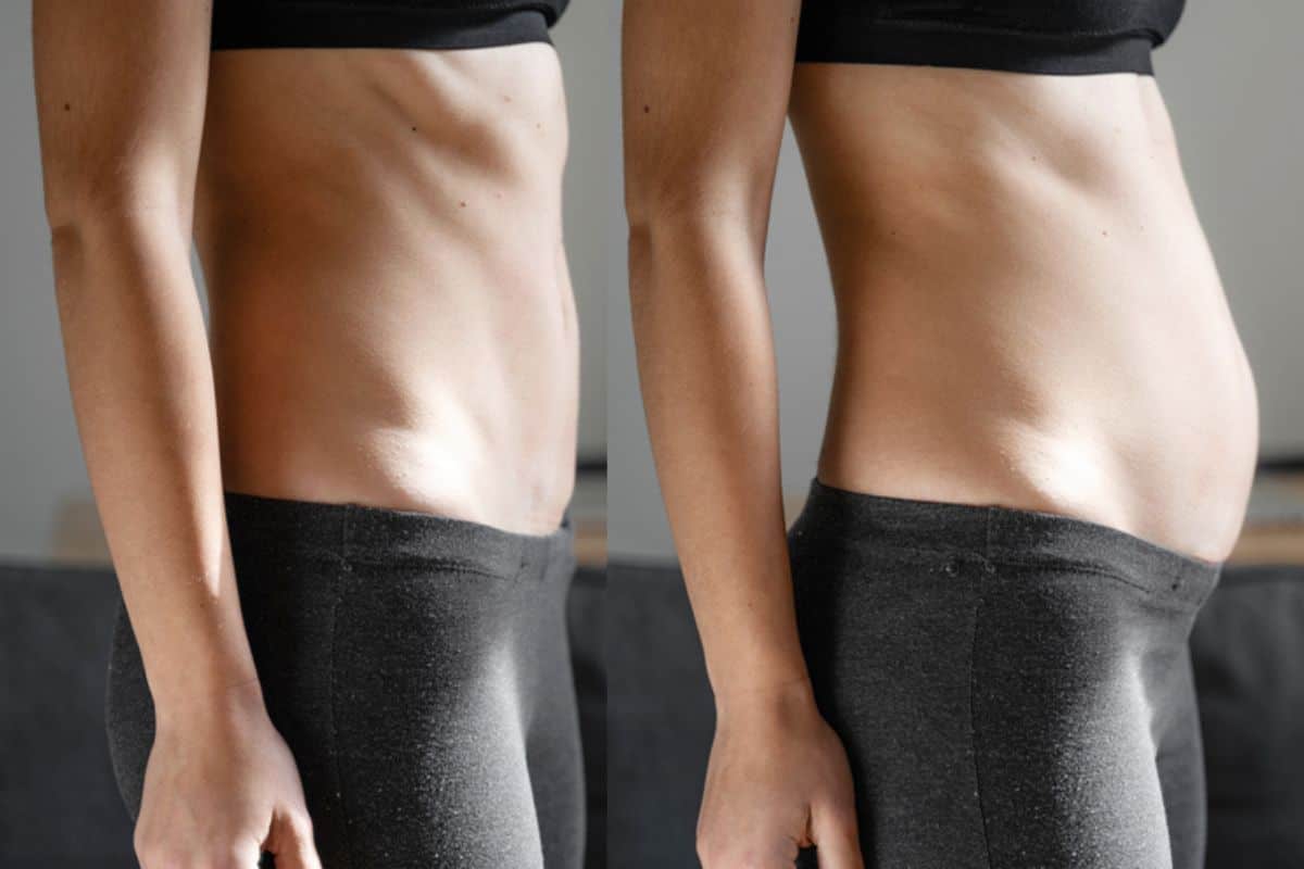 How long does diastasis recti take to improve Blackpool?