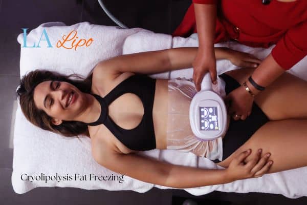 woman getting cryolipolysis Blackpool