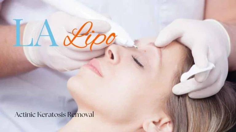 Woman receiving Actinic Keratosis Removal Treatment Blackpool