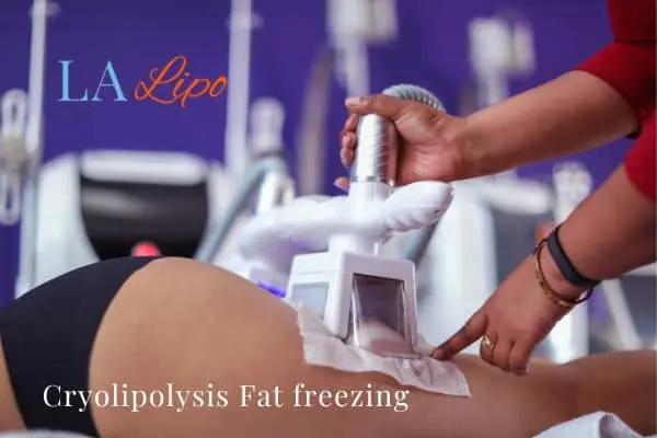women getting fat freezing Blackpool