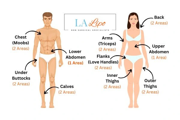 LA LIPO Cryolipolysis Areas Blackpool