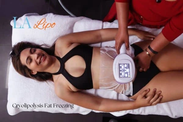 woman getting cryolipolysis Blackpool