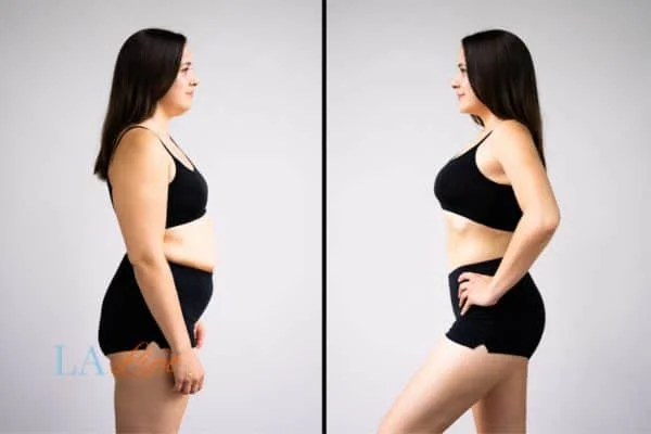 link between body image and mental health Blackpool