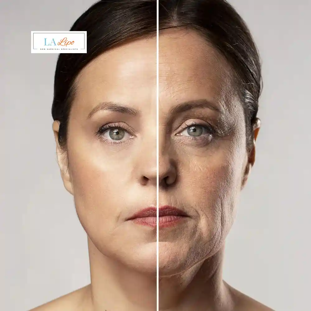 How Can You Tell If Non-Surgical Skin Tightening Is Right for You Blackpool?