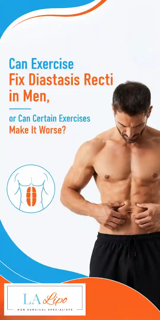 Can Exercise Fix Diastasis Recti in Men, or Can Certain Exercises Make It Worse Blackpool?